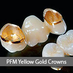 PFM-yellow-gold