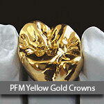 PFM-yellow-gold2