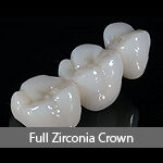 full-zirconia-crown